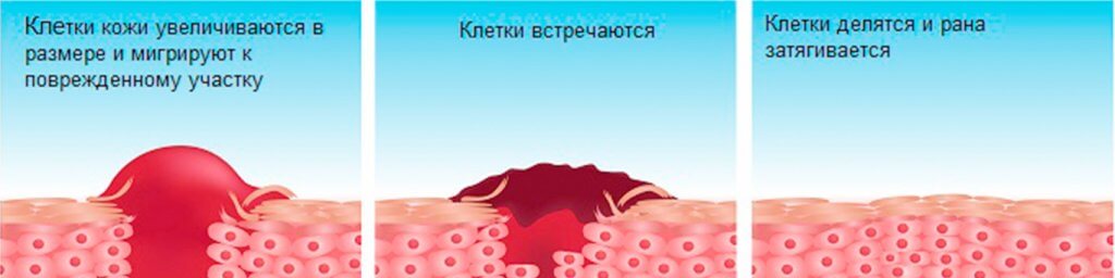 Инфографика Инфографика